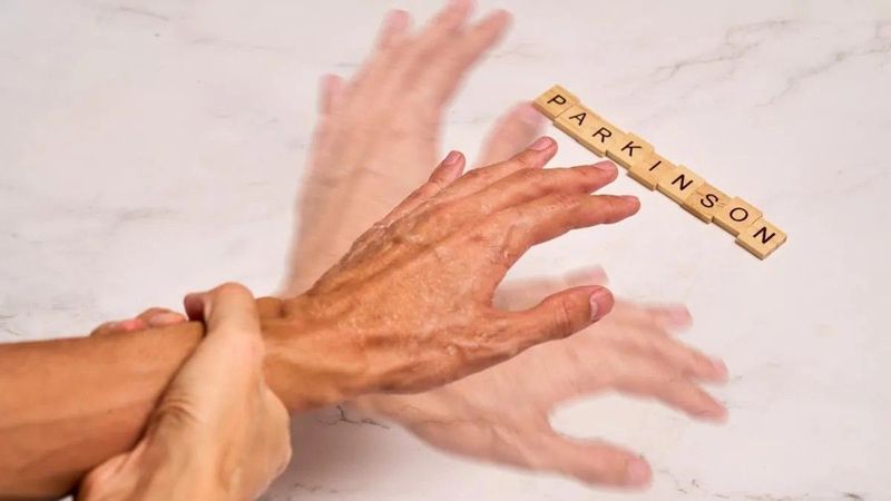 5 korai jel, ami a Parkinson-kór alattomos kezdetére utalhat