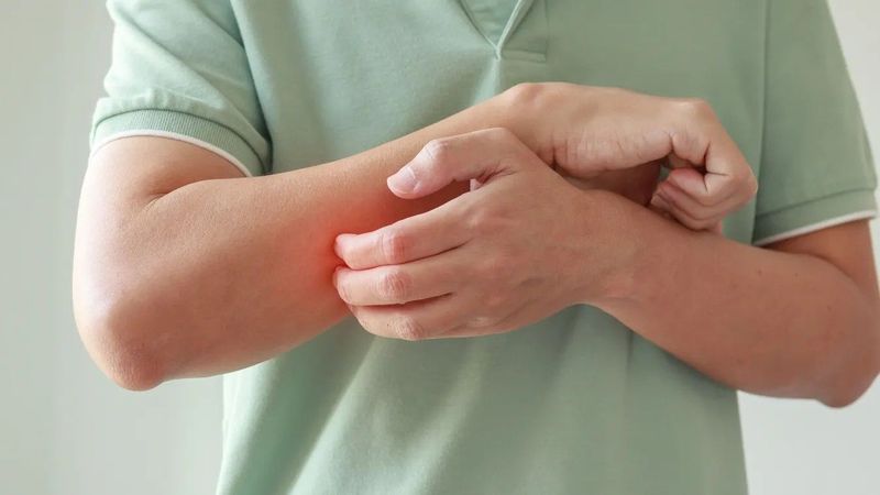 A bőrviszketés mögött komolyabb ok is állhat, érdemes odafigyelni a jelekre