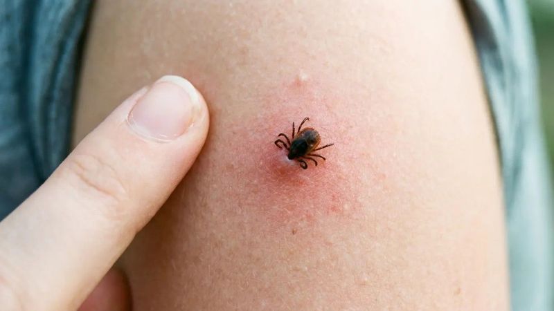 A kullancsok rejtett veszélyei: ezek a betegségek sokakat érinthetnek anélkül, hogy tudnák