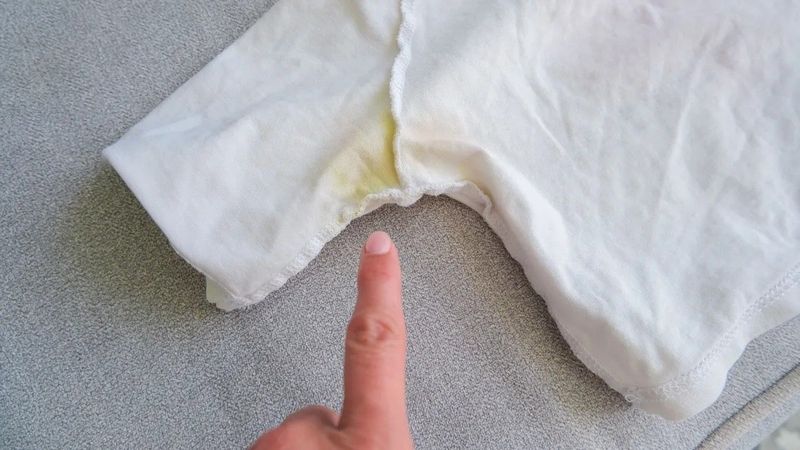 A fehér ruhák réme: így szabadulhatsz meg végleg a makacs sárga foltoktól
